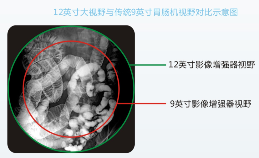 平板數(shù)字胃腸機